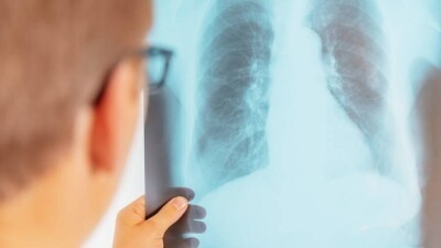 В ВОЗ заявили о рекордном росте смертности от туберкулеза за 10 лет