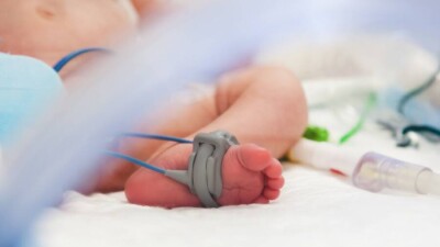 Мэр Москвы заявил о росте смертности от коронавируса среди детей