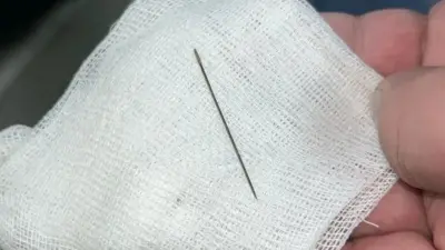 Подозревали корь, оказалась игла в животе: врачи спасли младенца в Туркестане