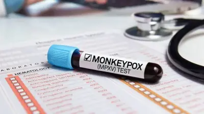 Новый штамм оспы обезьян обнаружили в Великобритании