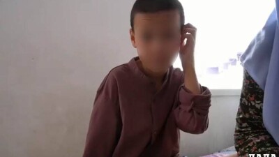 В Мангистау оштрафуют родителей ребёнка, которому ампутировали руку после лечения у знахаря