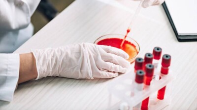 ВОЗ назвала новый штамм Covid-19 буквой омикрон и классифицировала его как вызывающий беспокойство