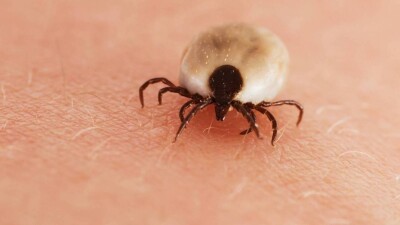 61-летний мужчина умер после укуса клеща в Шымкенте