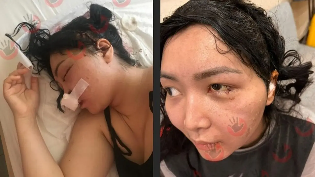 Проломил жене череп и размозжил лицо: осуждённого по делу Алтынай оставят в колонии-поселении