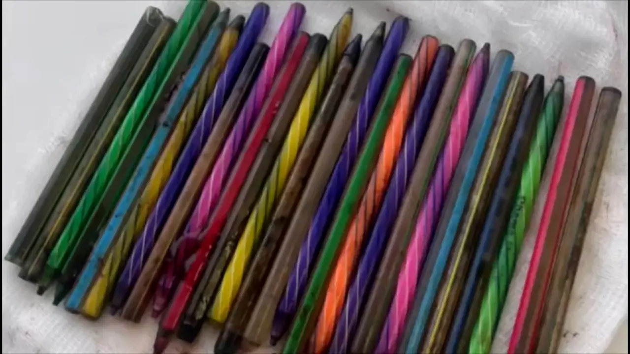 Инородные предметы, которые достали из желудка шымкентца / Фото управления здравоохранения города