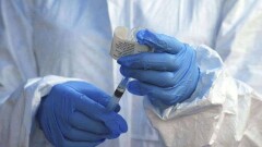 В Демократической Республике Конго произошла вспышка обезьяньей оспы, умерли 10 человек