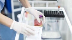 Ботулизм не подтвердился у умершего после отравления колбасой ребёнка в Шучинске