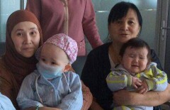 Страдающая лейкозом Тахмина Абышева прилетела в Стамбул на операцию