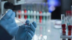 Число заражённых коронавирусом в Казахстане превысило 15 000 человек 