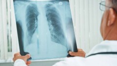 В Алматы врачи в день госпитализируют до 220 пациентов с пневмонией