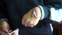Страшными язвами покрылись сельчане в ЮКО