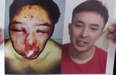 Движение SOS-Alibi в поддержку изуродованного парня разворачивается в Казнете
