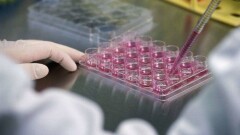 Впервые в Казахстане больному успешно пересадили неродственные стволовые клетки