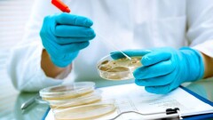 Минздрав опроверг информацию о лихорадке Денге у алматинки