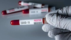 В Атырау коронавирусом заразилась медсестра. Она брала анализы на Covid-19