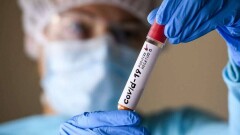  В Европе число случаев Covid-19 превысило 10 миллионов