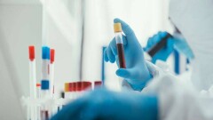 За сутки в Казахстане выявили 86 случаев заражения Covid-19, 206 человек выздоровели