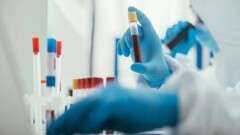 Минздраву поручили выяснить причины заражения медиков Covid-19 после отмены выплат 