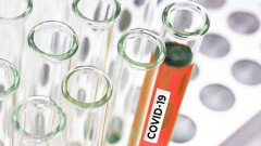 Число заражённых Covid-19 в Казахстане превысило 400 человек 
