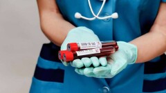 15 маусымда Қазақстанда коронавирус жұқтырған 383 адам тіркеліп, 4 науқас көз жұмды