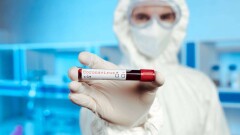 Число заражённых Covid-19 в мире превысило 46 млн человек 
