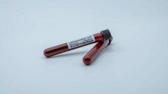 Число заражённых коронавирусом в Казахстане превысило 14 000 человек 