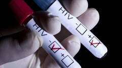 В Казахстане научились определять, когда человек заразился ВИЧ