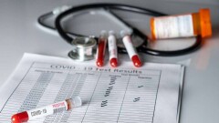 В Казахстане за сутки выявили 140 случаев заражения Covid-19 и 26 больных коронавирусной пневмонией