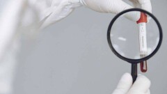 24 қыркүйекте Қазақстанда коронавирус жұқтырған 61 адам тіркелді