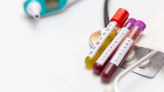 Лязат Актаева: Мы переходим в пиковую стадию, начинается полномасштабный скрининг на Covid-19