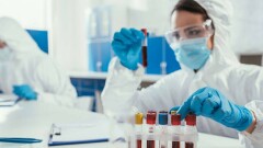 На Тенгизе коронавирус диагностировали ещё у 35 рабочих 