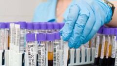 Спорткомплексы, фитнес-клубы и детские лагеря разрешили открывать при приросте заболеваемости Covid-19 до 2%