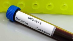 В Жамбылской области выявили ещё один случай заражения Covid-19