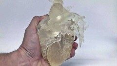 В Эквадоре учёные изобрели технологию печати 3D-органов с патологиями для помощи хирургам
