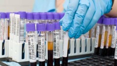В Актюбинской области больной с Covid-19 скрыл информацию о двоих контактных. Оба заразились