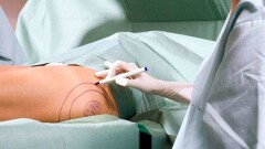 Смерть гражданки Украины после липосакции в Алматы: хирург выступил в суде
