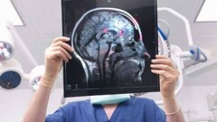 Связь между болезнью Паркинсона и сотрясением мозга выявили учёные