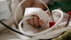 Опрокинувшему на себя кастрюлю с бульоном малышу из Кокшетау пересадили кожу