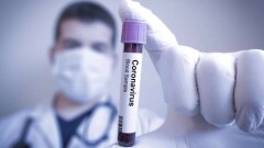 За сутки в Казахстане выявили 77 случаев заражения Covid-19. Нулевой прирост в Шымкенте и четырёх областях