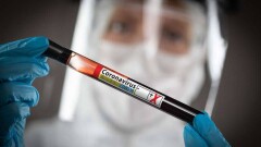 ВОЗ проведёт в Туркменистане собственное тестирование на Covid-19. Президент страны дал согласие