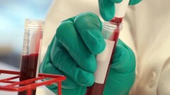 В "СК-Фармация" ответили на жалобы больных гемофилией о дефиците лекарств