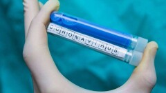 28 маусымда Қазақстанда коронавирус жұқтырған 547 адам тіркеліп, 12 науқас көз жұмды