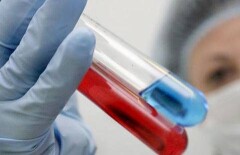 Актюбинские бюджетники обогнали наркоманов по заболеваемости ВИЧ 