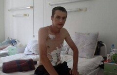 Врачи вытащили с того света мужчину, которого перерезало фрезой трактора в ЗКО