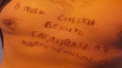 Актюбинец вырезал на груди имя следователя в знак протеста