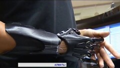 В Алматы 20-летней работнице фитнес-центра напечатали протез руки на принтере