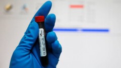 Двух казахстанских спортсменок поймали на допинге