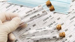 Число заражённых Covid-19 в мире превысило 11 млн человек 