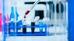 В Алматы зарегистрировали три новых случая заражения коронавирусом