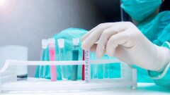 За прошедшие сутки в Казахстане коронавирус подтвердили ещё у 165 человек